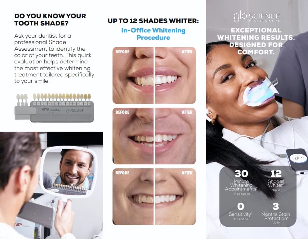 GLO professional teeth whitening results and tooth-shade guide