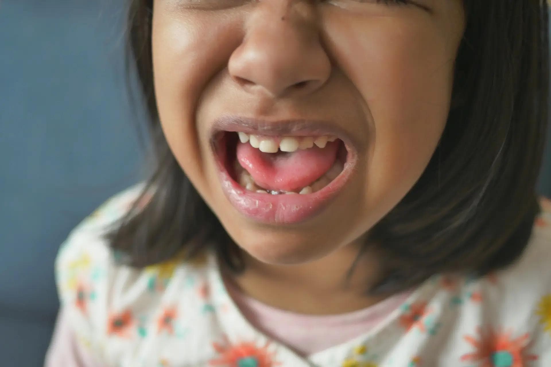 child dental emergency? expert tips from orillia's trusted dentists